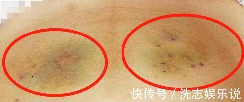 孙女|3岁孙女无故喊疼,奶奶掀开孩子衣服后,直接拿起电话报警