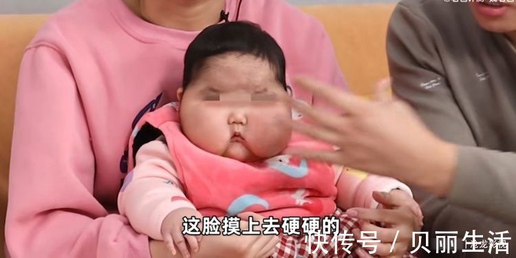 沧龙|“大头娃娃”卷土重来?5个月孩子用母婴产品变成大头娃娃!