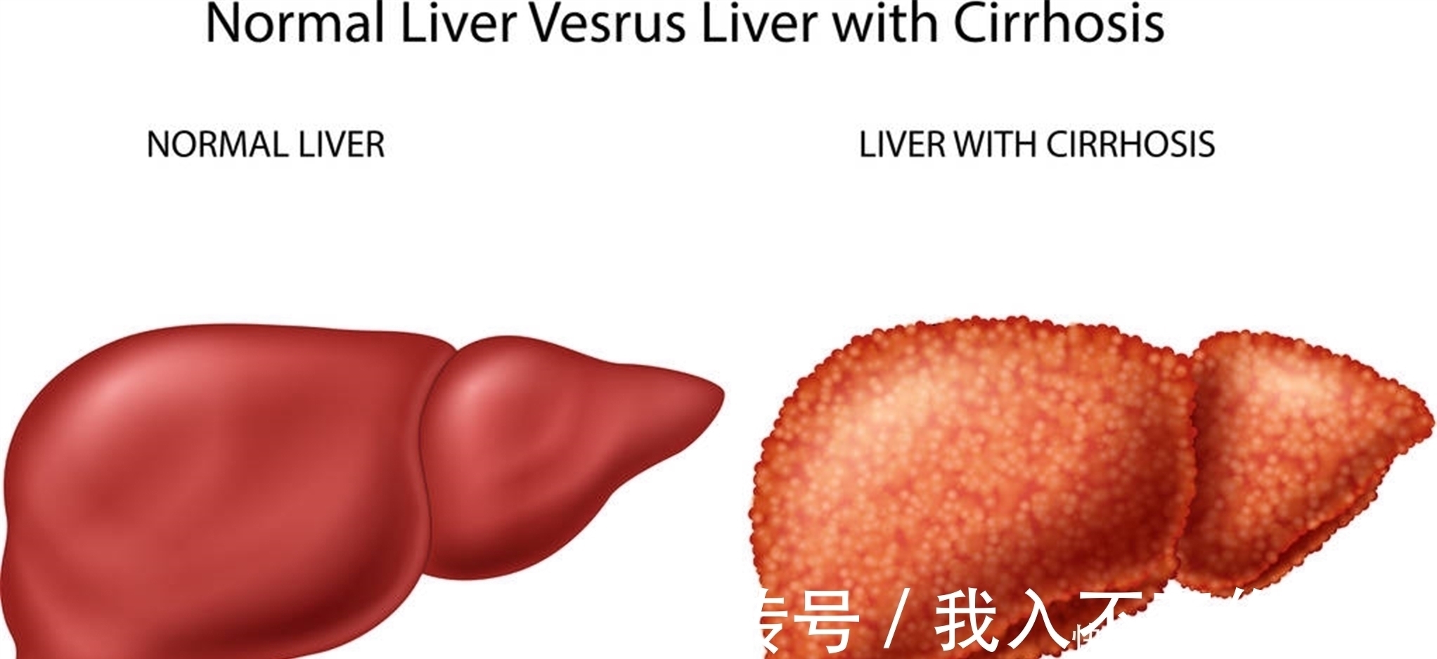 消化不良|陈皮和它“天生一对”,泡水喝点,健脾养肝,血管干净不堵塞