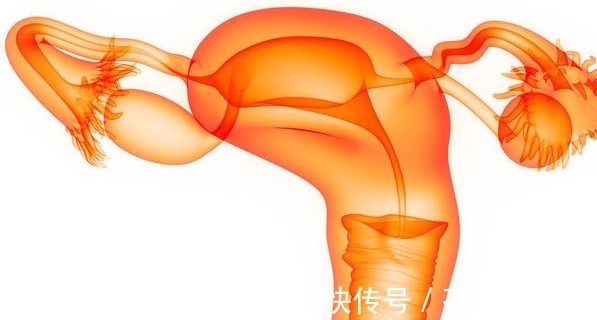 hpv|女性宫颈癌有4个标志,症状越多,提示病情越严重,希望你1个没有