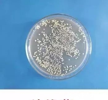 线菌|男子手摸一物后住院7次，这种古玩不要随便乱摸，不小心会丢命!