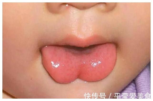 宝宝|苹果水能缓解小儿积食?医生建议:要想脾胃好,这2物要少吃