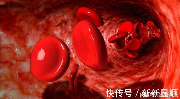 阿尔茨海默症|医生30年经验总结:4个方法轻松对付高血脂,别只知道傻傻吃药