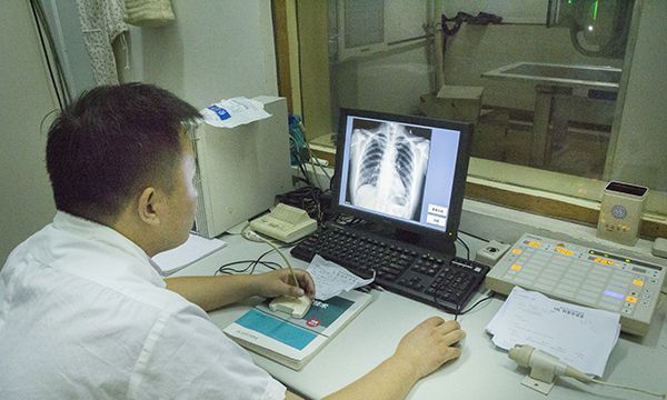 辐射量|CT辐射有多大,会不会致癌?做完CT后,辐射多长时间才能消除?