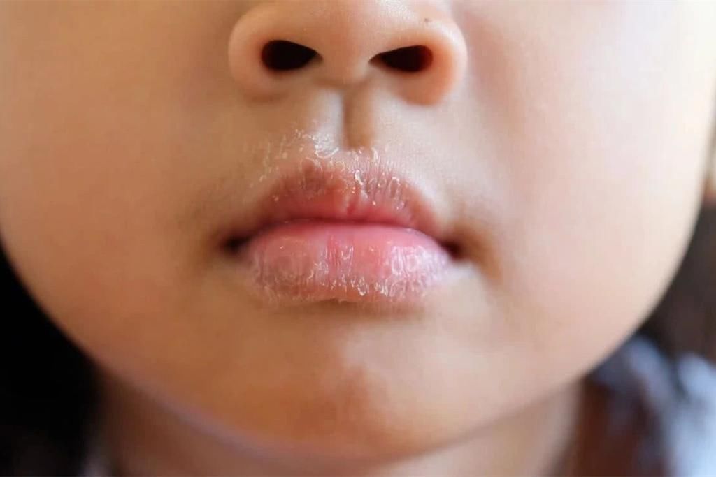 自查|因为1个习惯动作，5岁男童被抽血4次，这个安全隐患宝妈快自查