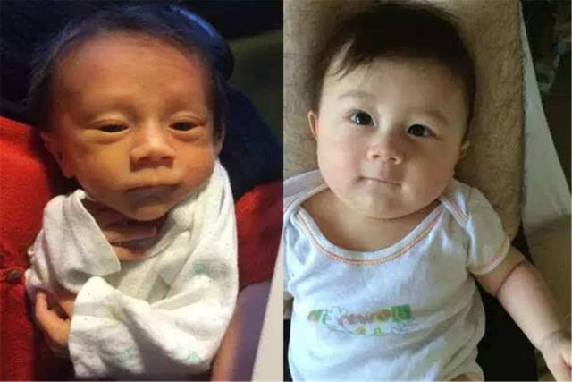 宝宝|“最美新生儿”刚出生就成网红,凭颜值征服网友,护士:难得一见