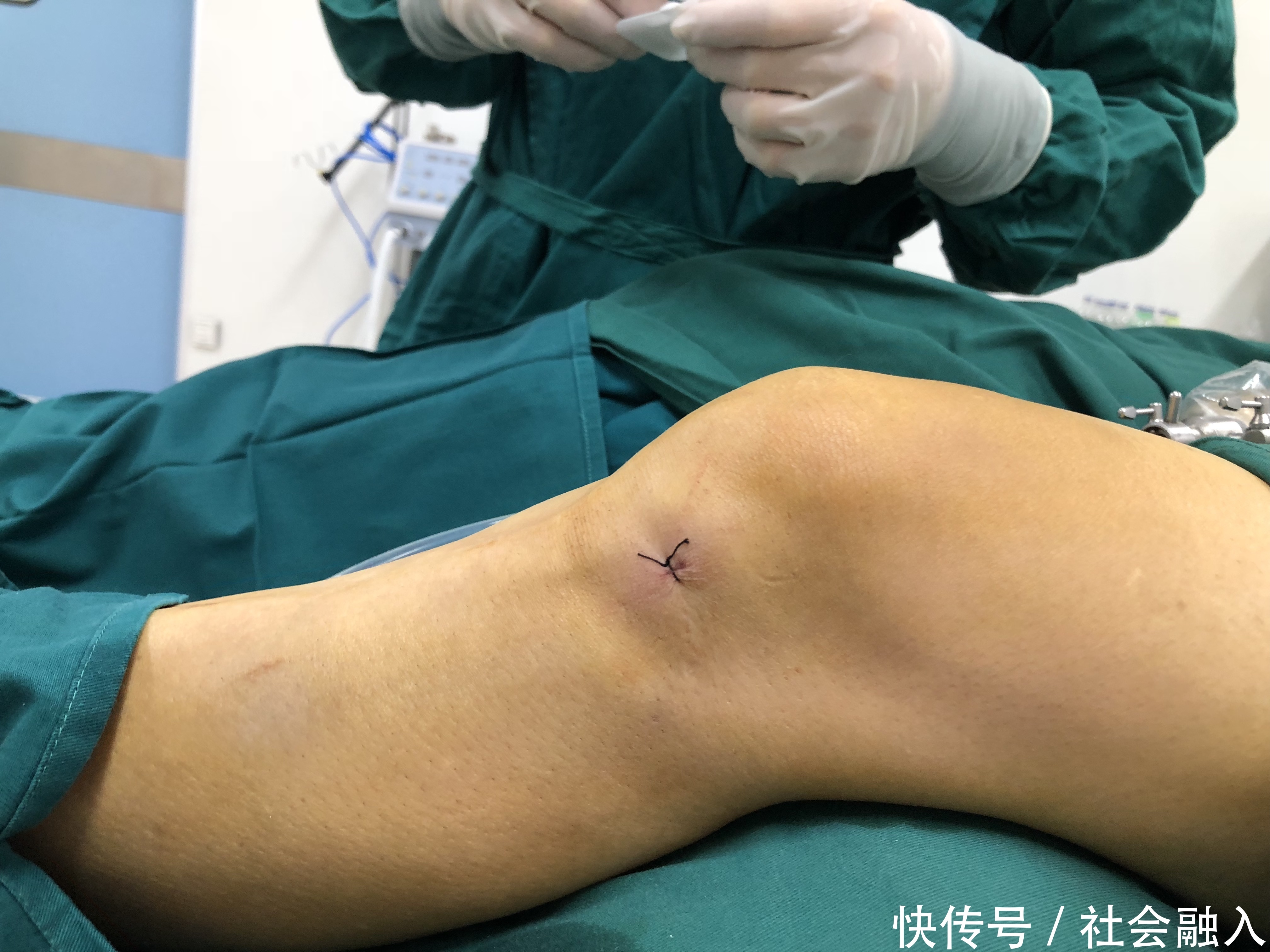 中老年人常受骨关节炎困扰,如何阶梯治疗减轻疼痛避免畸形