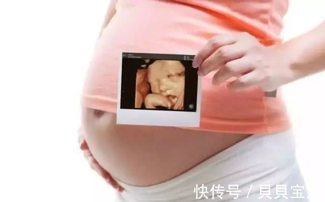 胎头双顶径|关于四维彩超检查,我们给你整理了这些Q&A!