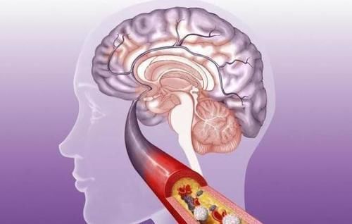 心脑血管|3种调料,正在“偷偷”升高你的血糖,劝告父母,能不放就不放