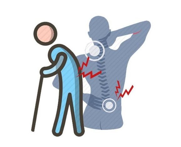 骨痛|年级越大,越要预防骨质疏松!身体出现4个征兆,及时补钙