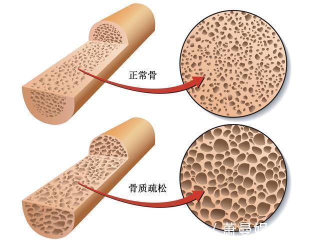 绝经|女人雌激素快要“干涸”，身体会有4个异常信号，别视而不见