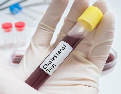 高血脂|甘油三酯“害怕”一物,不是大蒜,水里放一勺,血脂乖乖下降