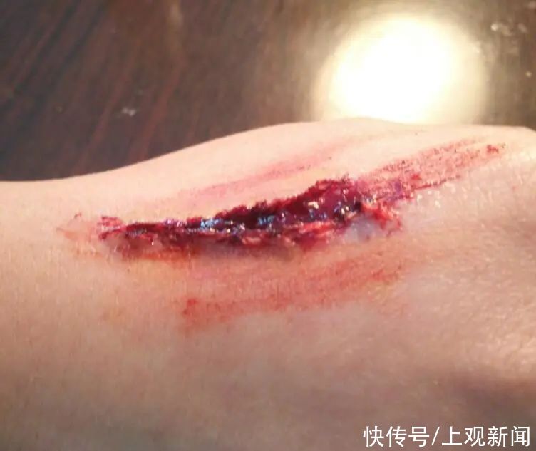 创可贴|小小的创口贴，学问可不少