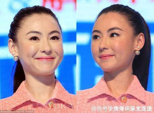 初恋这件小事|女明星注射面部逐渐“馒化”,要不要去整容?先问问她们再说吧!