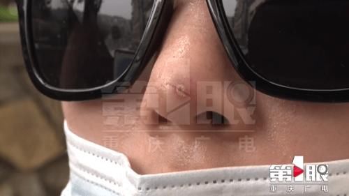 美女想要变得更美 整形后非常后悔