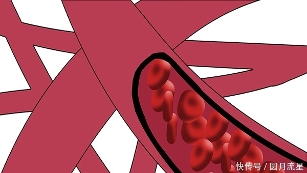 能量|癌症患者，突然吃得好，睡得香，说明病情在好转吗？告诉你答案