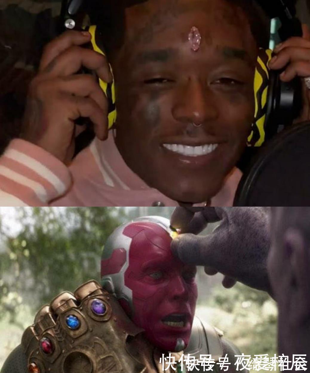 粉钻$人类对珠宝的痴迷能到什么程度,有人把1.5亿的钻石装在脑门上