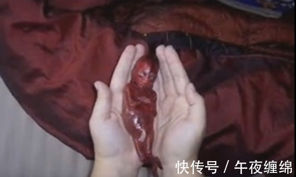 女子|女子生下3指大的婴儿,让在场所有医护人员都震惊了