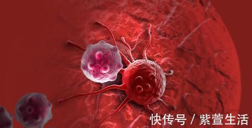 癌症复发|同样的癌症,1年后复发和3年后复发有何不同医生发现一个规律