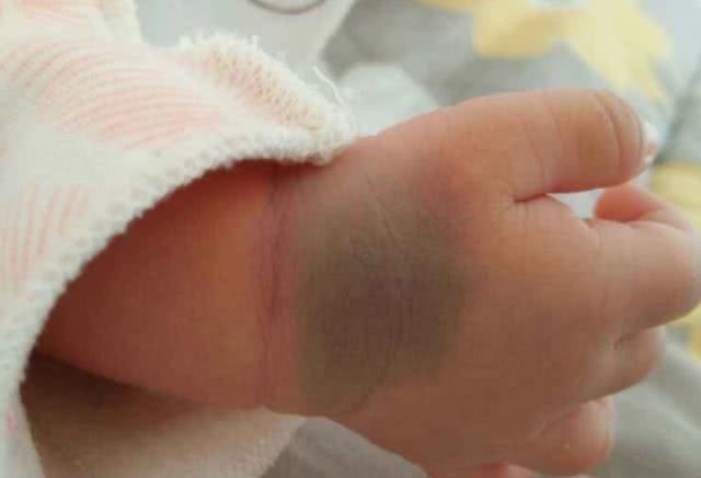 怀孕|怀孕时,孕妇最好别做这4事,当心宝宝身上会留“胎记”,再喜欢也要忍住