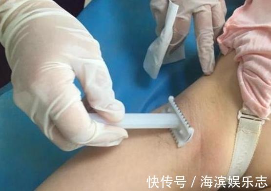 产妇|男医生要给产妇“刮毛”,丈夫自告奋勇,医生你想的太简单了