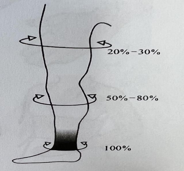 治疗|你知道治疗静脉曲张压力袜和淋巴水肿压力袜的不同吗？