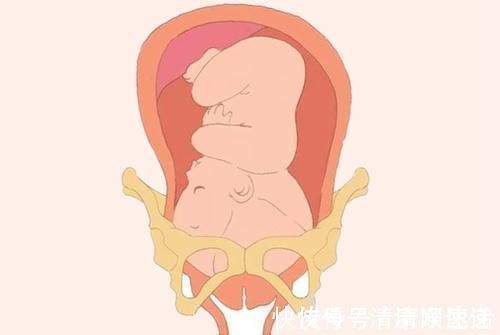 入盆|胎儿何时入盆?入盆啥信号?入盆啥时候卸货?准妈妈必知一文讲清