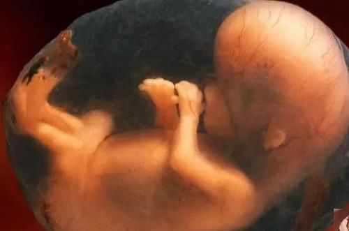 怀孕|为什么有人怀孕的时候肚子大,而有人怀孕的时候肚子小?