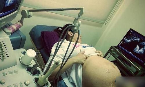 “我天天喝水,怎么会羊水过少呢?”多数准妈都理解错了