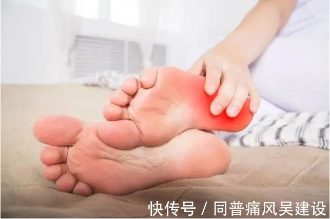 诱发|关于痛风的那些事,这篇文章给你讲透