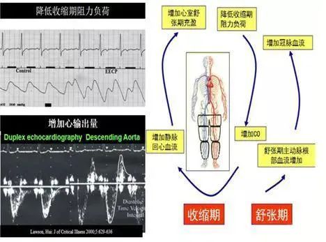 收缩期|潍坊市人民医院专家为您讲解什么是体外反搏？