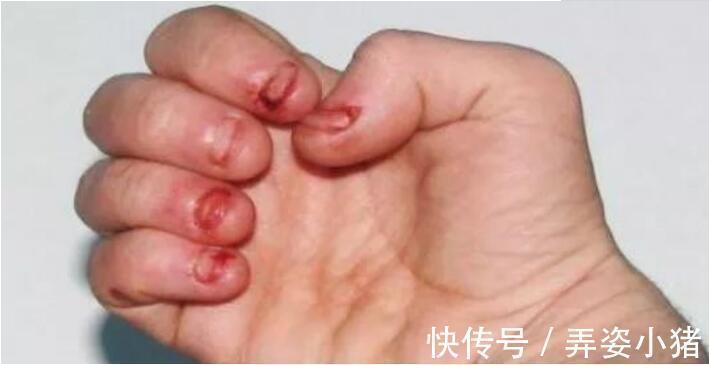 宝妈|小时候喜欢“啃指甲”的孩子,长大后会怎样无法避开这几种结局