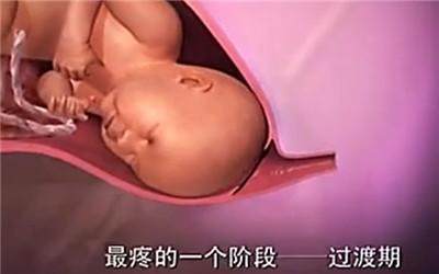 胎头那么大,到底是怎样从那么小的口出来顺产分娩全过程-附图