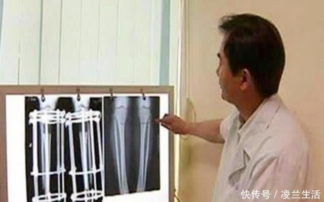 小陈|孩子“不长个”前,骨骺线会发出3个信号,家长早发现能再长5厘米