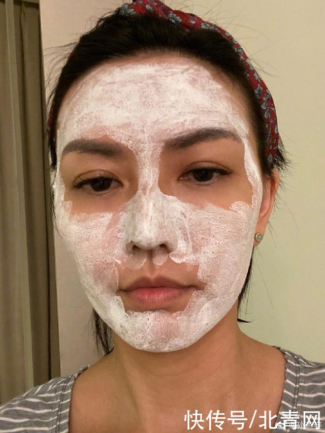 孙燕姿晒自己生活照 自曝压力大长痘忙敷面膜