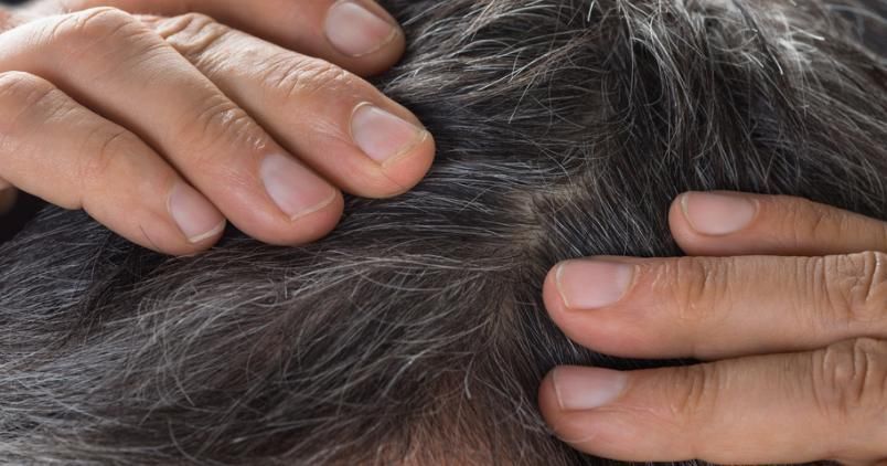 早生白发先不要发愁，送你一个方法，只花时间不花钱，来试试吧