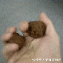 朋友|建议男生都替自己朋友看看,有没有这种男科疾病