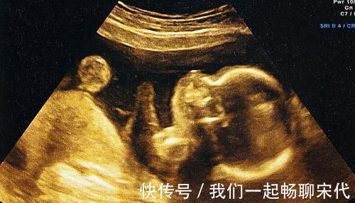 宝宝|胎儿大脑有3次发育“高峰”,孕妈2种营养不能少,宝宝出生更聪明