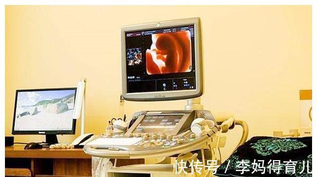 四维彩超|四维彩超不好过?医生:那是你没有提前了解注意事项