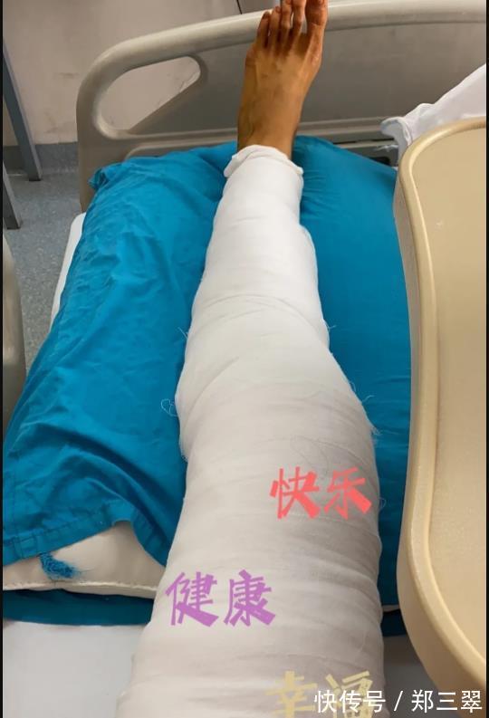 李盈莹|关心则乱！朱婷的手腕手术迟迟未定，放弃2022年世锦赛冠军了吗？
