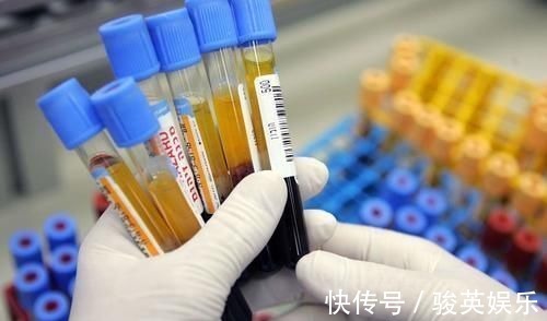 部位|你的眼睑上有小黄瘤子吗?是不是血脂高的象征?营养师说出答案