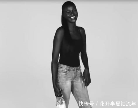 落入凡间|乌克兰美女患白化病，全身一片雪白，宛如天使落凡尘！