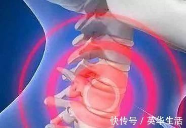 颈部|头晕手麻?粗盐搭配它,效果很厉害,坚持一个月,告别颈椎病