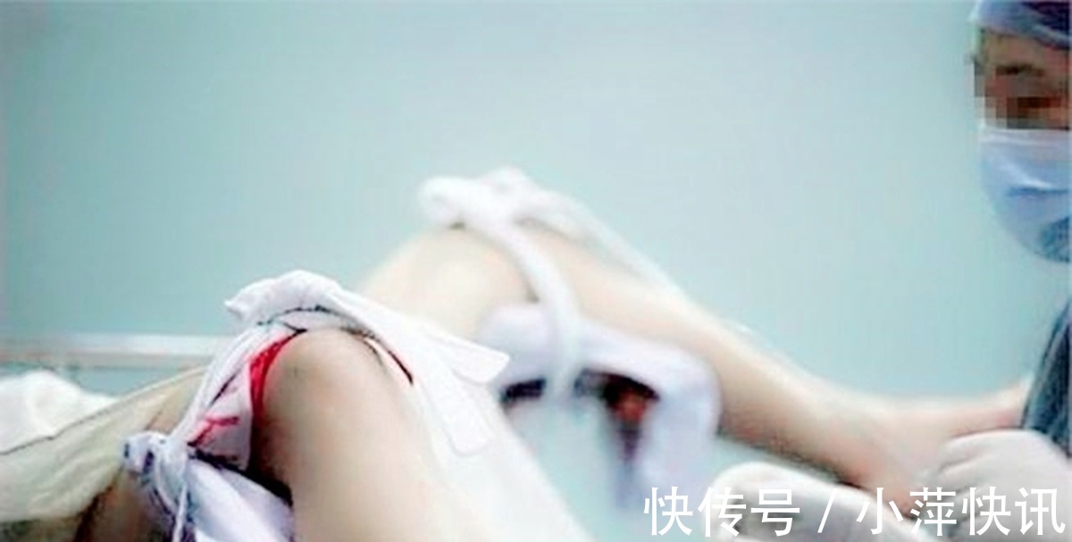 胎儿|“我都生完半小时了,你还掏什么”产妇怒斥男医生,只因下面疼痛