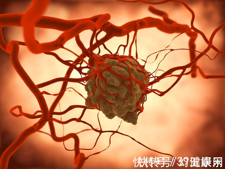 放射治疗|七旬肿瘤专家患癌,每月化疗8次,临终前遗言:没想到癌症这么痛