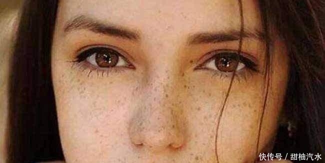 维生素c|脸上有斑太让人烦恼了 别急,教你几种不错的祛斑方法
