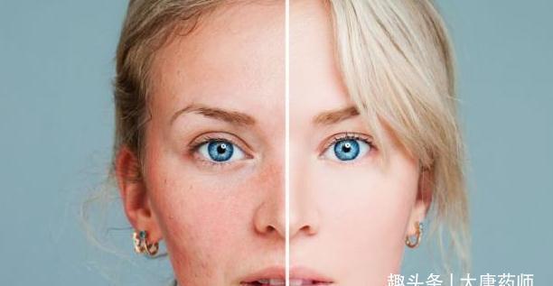 四物汤|千古补血第一良方!简单4味药,气血双补,美容养颜,做冻龄女神