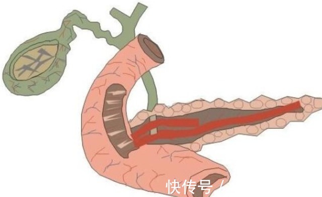 医生|转氨酶升高是肝脏不好吗?医生提醒:几个原因不容忽视