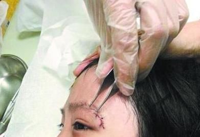 艺人|《中餐厅》安全隐患多,节目录制棚顶塌陷,艺人稍有不慎就会摔倒