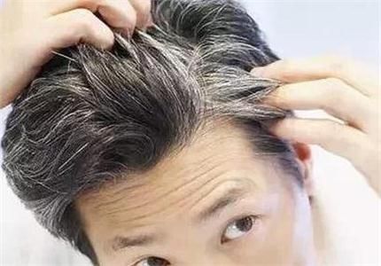 白头发长在哪里是最危险的地方？